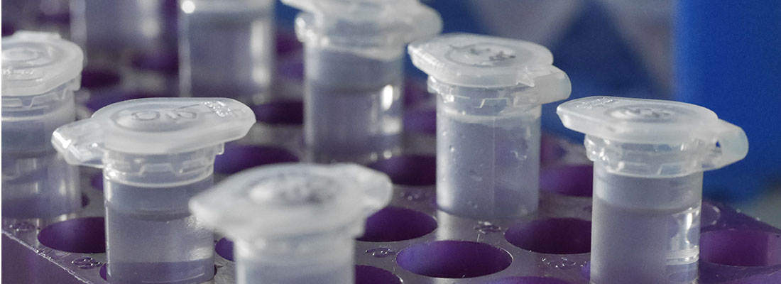 Department of Biochemistry - Eppendorf Tubes